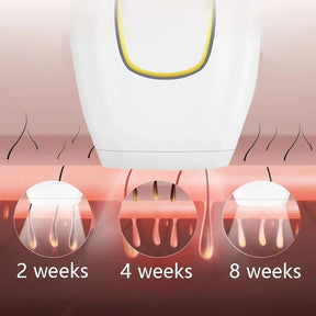 IPL Laser Hair Removal Device